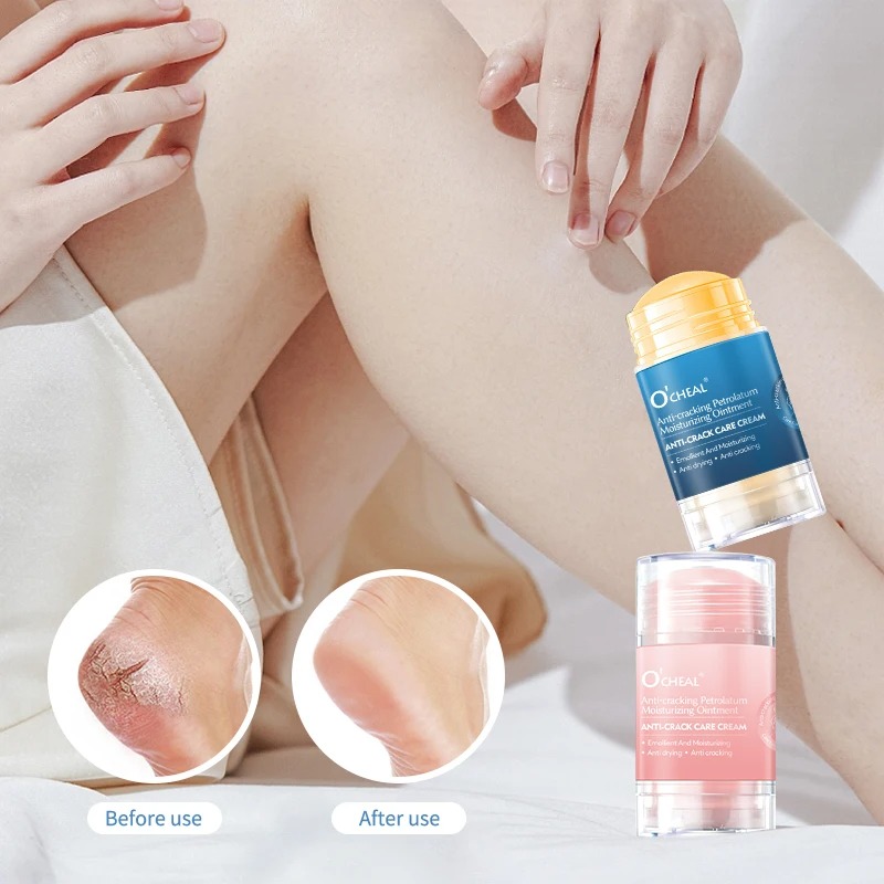 Heels - Anti Crack Foot Cream For Dry